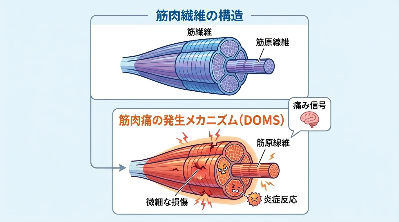 本文中:筋肉痛のメカニズムセクション